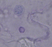 viral inclusion with an Azure A stain