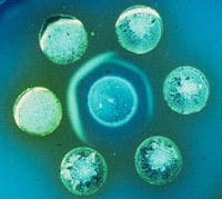 Immunodiffusion wells