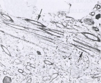 Potyvirus Cylindrical Inclusions: Pinwheels and Scolls