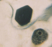 Tobacco mosaic inclusions