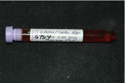 Adequate fluid specimen submission