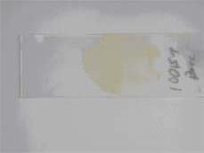 Adequate blood film