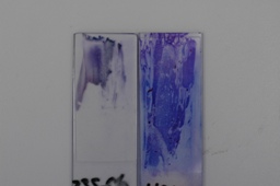 Adequate cytological specimen: Thin preparation. Material located at one edge of the slide and homogeneously smeared. It is recommended to submit two smears, one with no fixative and the second cytospray-fixed right after specimen is smeared.
