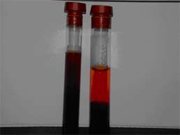 Hemolysis